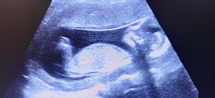 wizualizacja USG płodu w 17 tygodniu ciąży