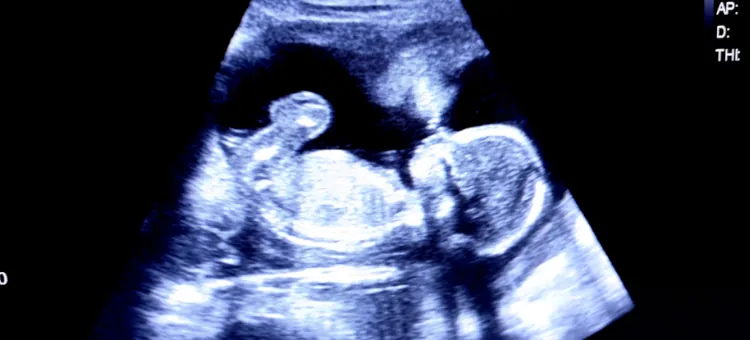 Płód w 16. tygodniu na obrazie USG