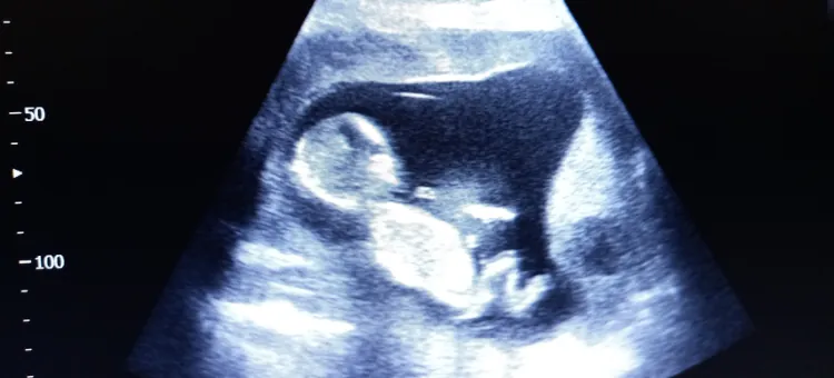 Zdjęcie fragmentu monitora aparatu USG, przedstawiające płód w 14. tygodniu ciąży 
