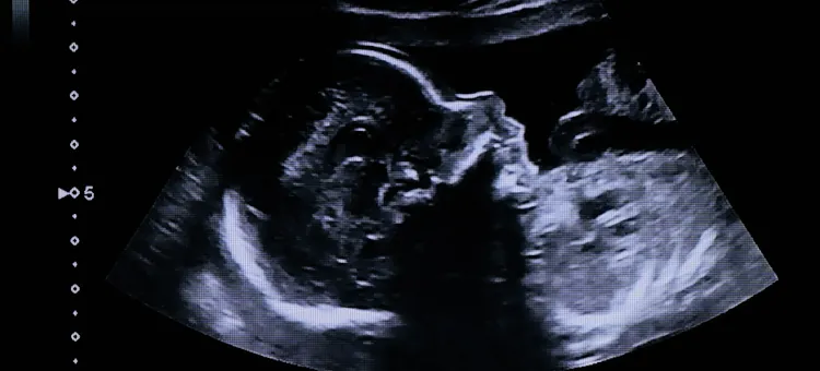 Badanie usg w połowie ciąży, zdjęcie profilu twarzy i klatki piersiowej płodu w 20 tygodniu