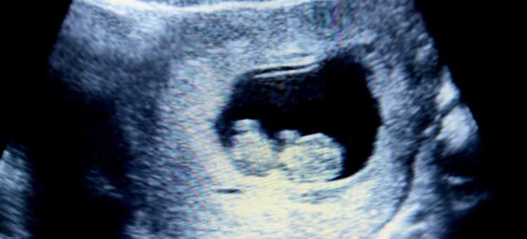 wizualizacja USG płodu w 12 tygodniu ciąży