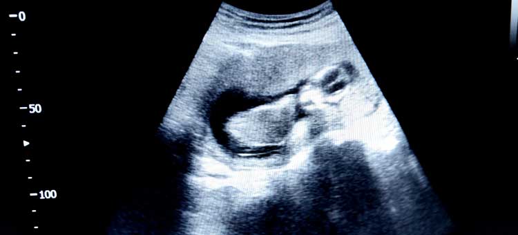 wizualizacja USG płodu w 15 tygodniu ciąży