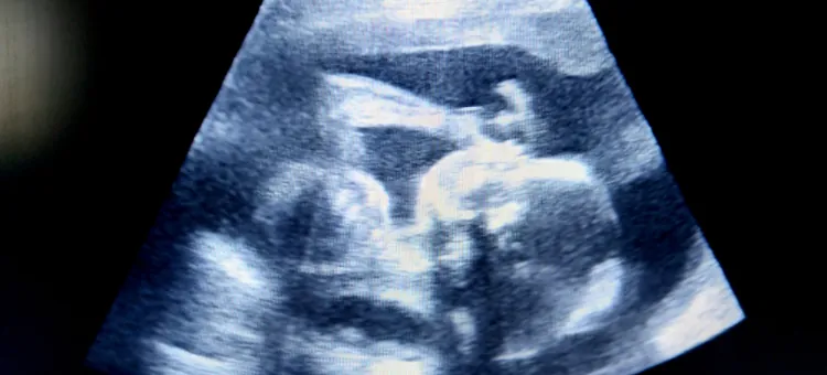 Zdjęcie USG zarysu dziecka w łonie matki w 26. tygodniu ciąży