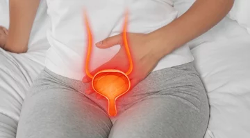 Wizualizacja pęcherza moczowego z zaznaczonym stanem zapalnym, obrazująca zakażenie dróg moczowych po porodzie