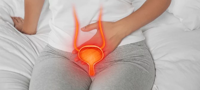 Wizualizacja pęcherza moczowego z zaznaczonym stanem zapalnym, obrazująca zakażenie dróg moczowych po porodzie