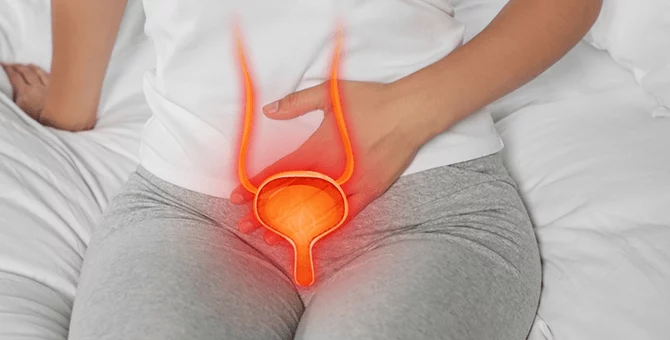 Wizualizacja pęcherza moczowego z zaznaczonym stanem zapalnym, obrazująca zakażenie dróg moczowych po porodzie