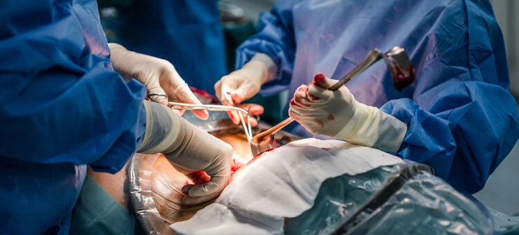 Chirurdzy przeprowadzający operację chirurgiczną porodu przez cesarskie cięcie