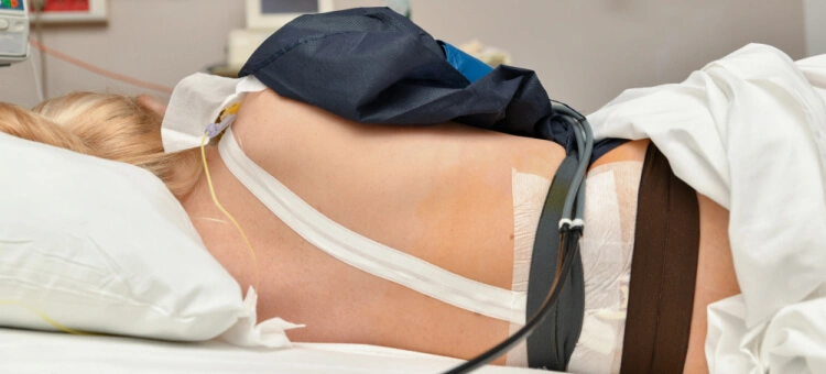 Leżąca kobieta ze znieczuleniem zewnątrzoponowym przed porodem