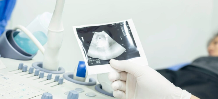 Zdjęcie USG ciąży trzymane przez lekarza w rękawiczce podczas badania