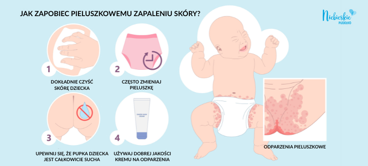 Infografika na temat jak zapobiec pieluszkowemu zapaleniu skóry