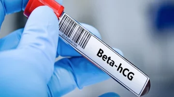 Probówka z próbką krwi do badania beta hCG wykrywającego wczesną ciążę