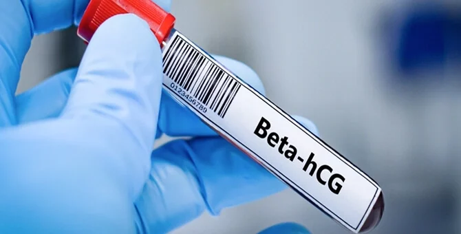 Probówka z próbką krwi do badania beta hCG wykrywającego wczesną ciążę