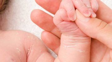 skóra niemowlęcia