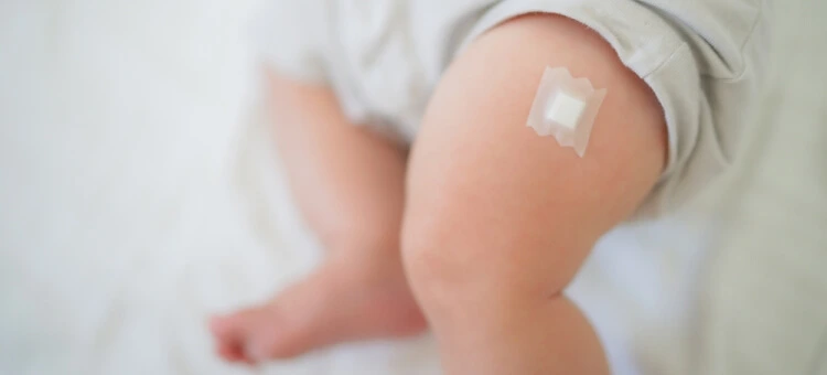 Jakie są zalety szczepienia 6w1? Noga niemowlęcia z plastrem po szczepieniu – możliwe reakcje po szczepionce 6w1