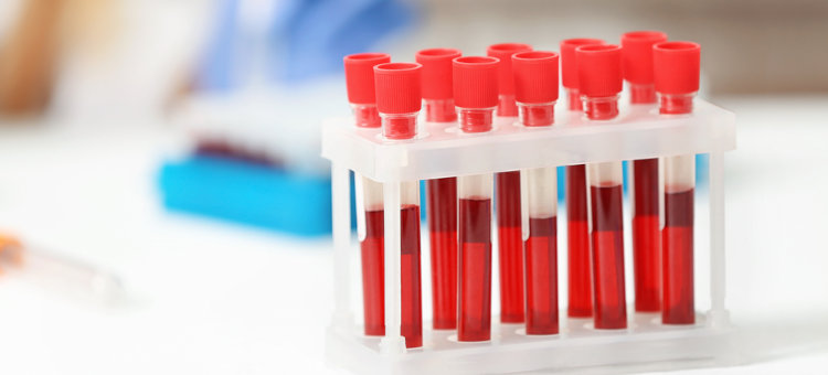 Próbki krwi w pojemniku na stole