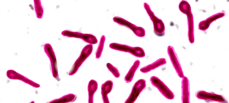 Bakterie Clostridium tetani jako przyczyna tężca, zdjęcie bakterii pod mikroskopem