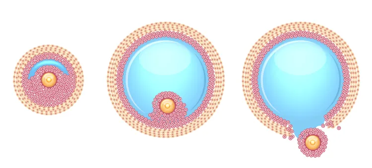 Ilustracja schematyczna niektórych etapów owulacji, podczas którego komórka jajowa jest uwalniana po pęknięciu pęcherzyka Graafa o okrągłym kształcie