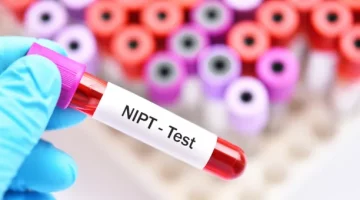 Próbka krwi do badania NIPT w diagnostyce trisomii u płodu u kobiety w ciąży