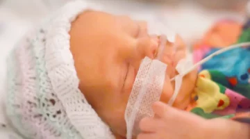 Niemowlę leży z założonym sprzętem medycznym, z podłączonym tlenem, pod czujną troską