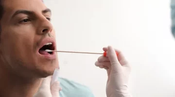 Mężczyzna przechodzący pobieranie próbki dna z jamy ustnej patyczkiem w celu np. zbadania możliwego ojcostwa
