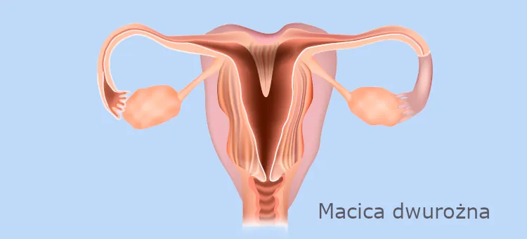 FAQ Anatomiczny rysunek narządu nietypowym kształcie - macica dwurożna