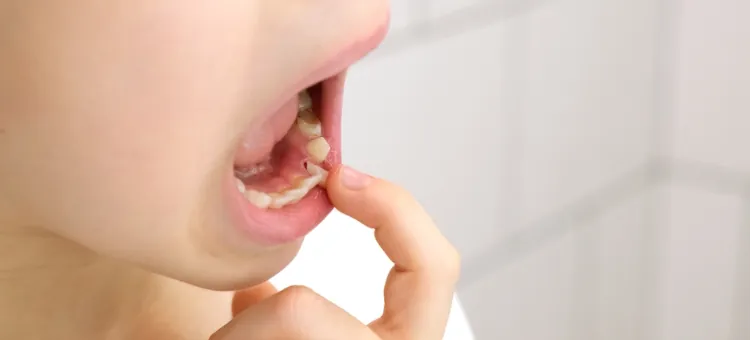 Jak usuwać mleczaka? FAQ Dziecięca dłoń kontroluje miejsce po utraconym mleczaku w szczęce