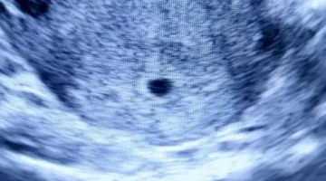 Czarny punkt pęcherzyka ciążowego we wczesnej ciąży na monitorze aparatu ultrasonograficznego w niebieskich odcieniach